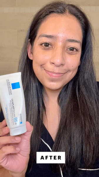 Foresto after applying the La RochePosay Cicaplast Balm B5