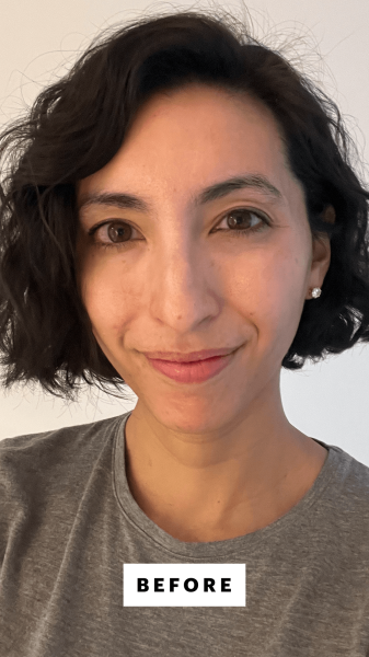 Pai before applying the SkinCeuticals A.G.E Advanced Eye